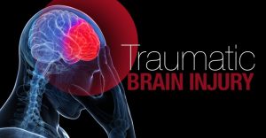 The 10 Biggest Myths about Traumatic Brain Injuries