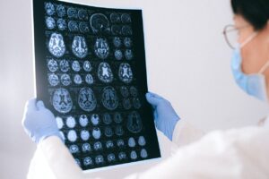 brain-injury-scan