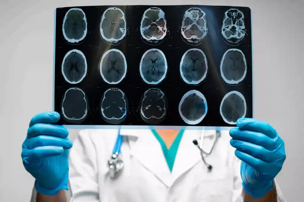 Hands of a doctor holding a brain scan